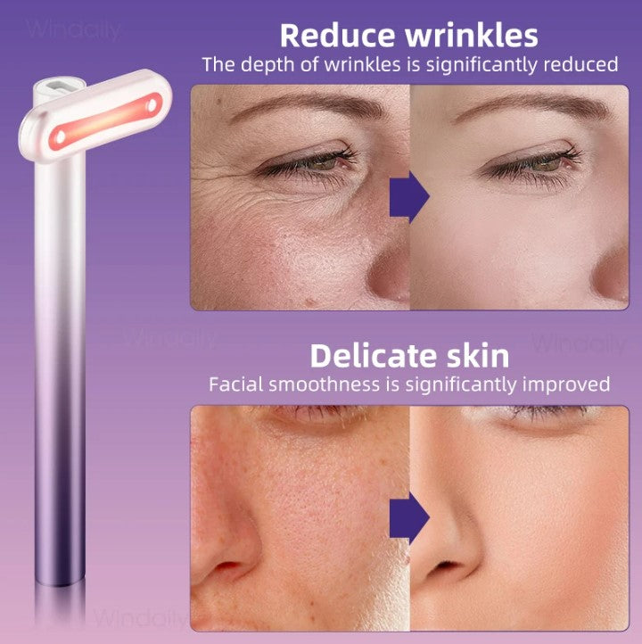 4 in 1 Facial Wand EMS Microcurrent Vibration Warm Red Light Face Lifting Machine Skin Tightening Device - Blue